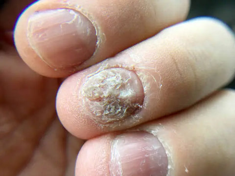 7 nail symptoms and conditions you shouldn't ignore - TODAY